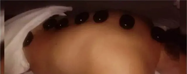 Vulkansko kamenje poređano duž leđa